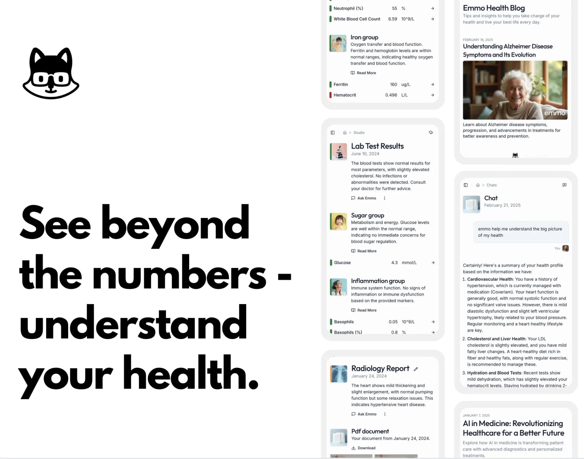 Emmo homepage screenshot — Understand Your Medical Files with AI – Take Charge of Your 