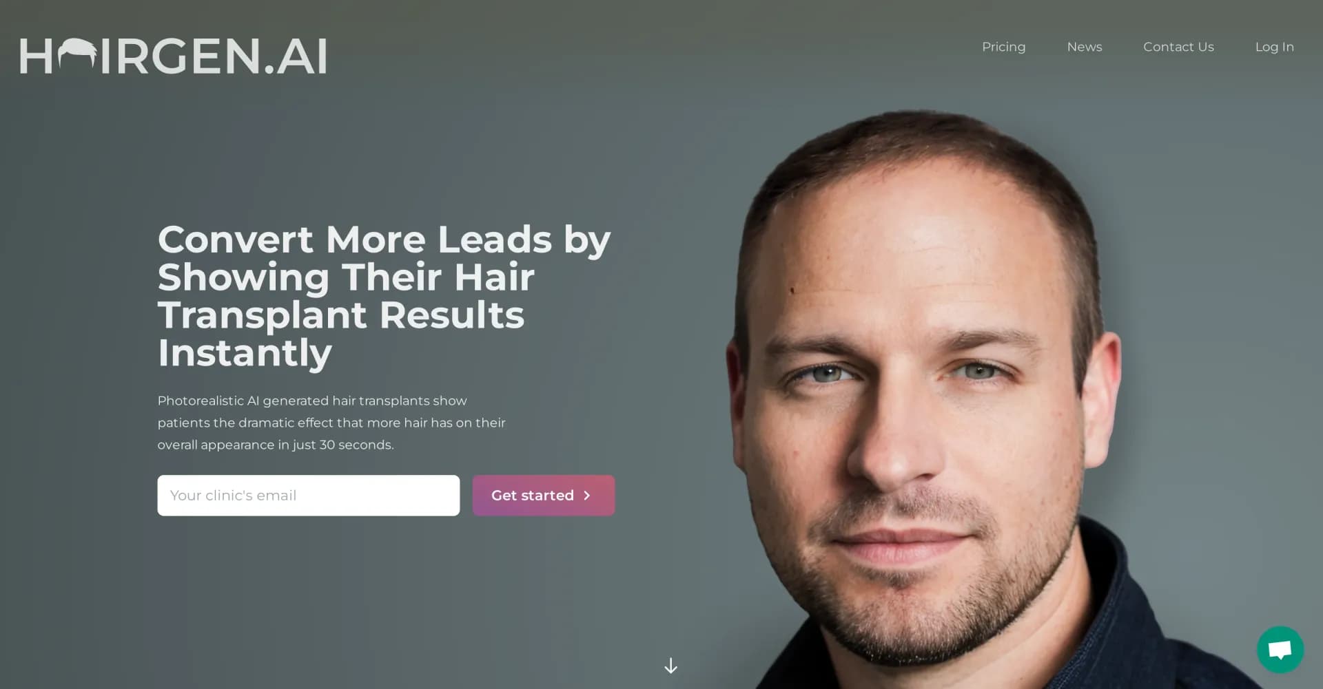 Hairgen.ai homepage screenshot — Preview your hair transplant results instantly with AI.